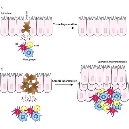 Figure 2. Aberrant cell death in chronic inflammation. 